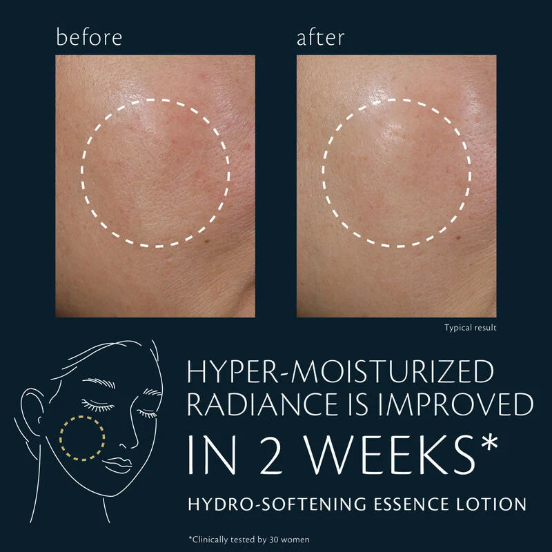 Hydro-Softening Lotion