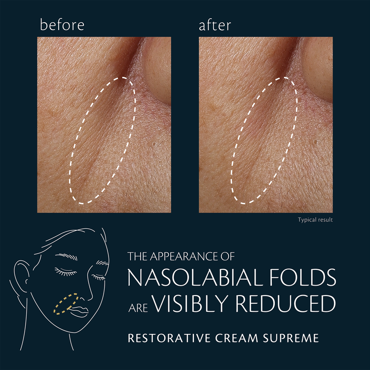 Restorative Cream Supreme